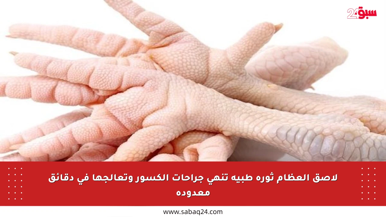 لاصق العظام ثورة طبية تنهي جراحات الكسور وتعالجها في دقائق معدودة